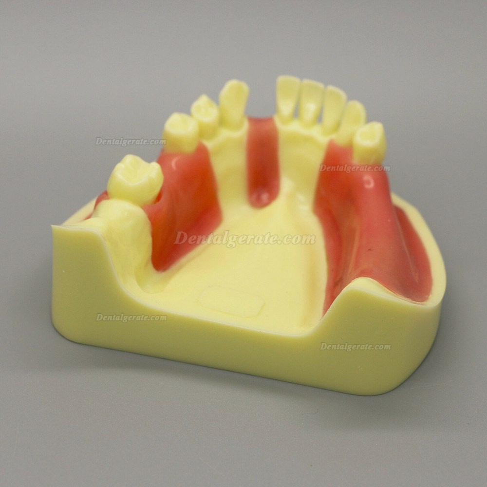 Dental Model # 2004 01 - Unterkieferimplantat-&Uuml;bungsmodell mit Gingiva